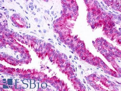 PathPlus™ GPR25 Antibody (C-Terminus)