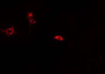 TIMP2 Antibody