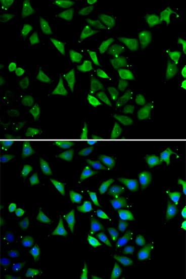 EIF3C / EIF3S8 Antibody