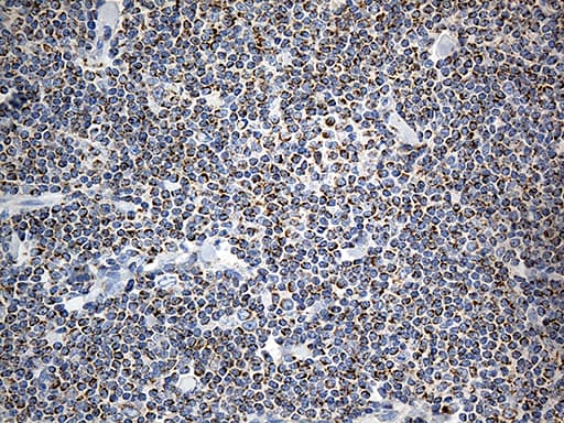 MTX2 Antibody (clone OTI2E9)