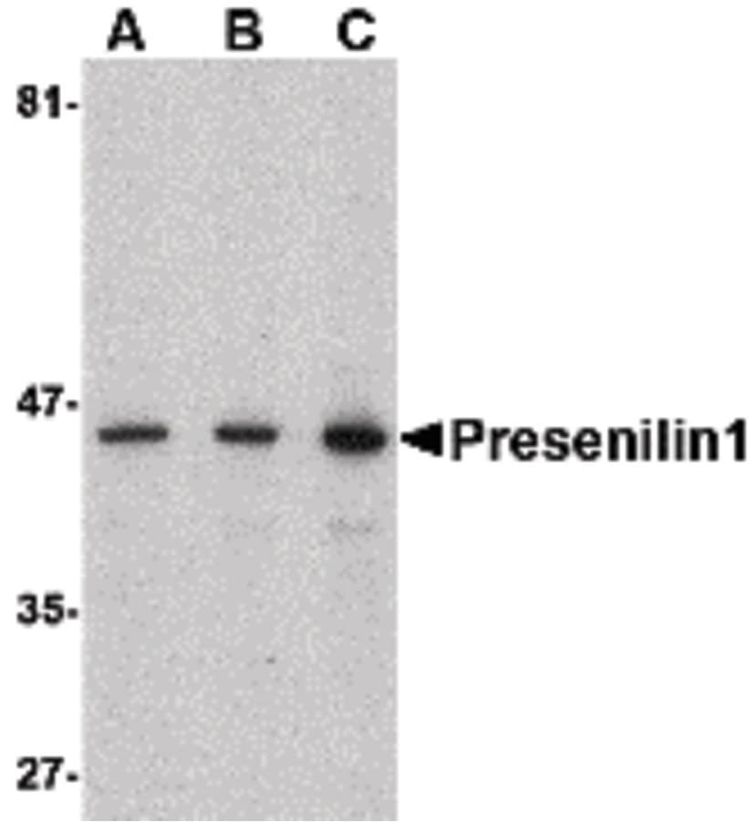 IHC-plus™ PSEN1 / Presenilin 1 Antibody