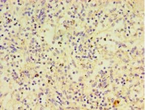 PTPN5 / STEP Antibody (aa300-555)