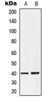 Polyclonal Rabbit anti-Human LPAR3 / LPA3 / EDG7 Antibody (C-Terminus, IHC, WB)