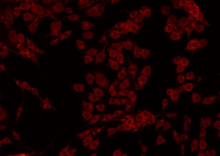 Polyclonal Rabbit anti-Human CPB2 / TAFI Antibody (IF, WB)