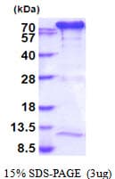 Human TGM2 / Transglutaminase 2 Protein (Recombinant His)