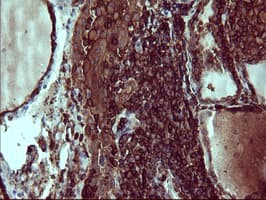 CD45 / LCA Antibody (clone OTI1B6)