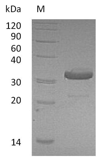Human IGHG1 / IgG Protein (Recombinant)