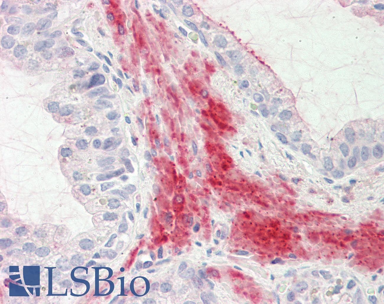 IHC-plus™ DUSP6 / MKP3 Antibody (aa14-201)