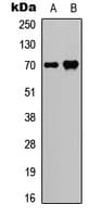 SPHK2 Antibody (C-Terminus)