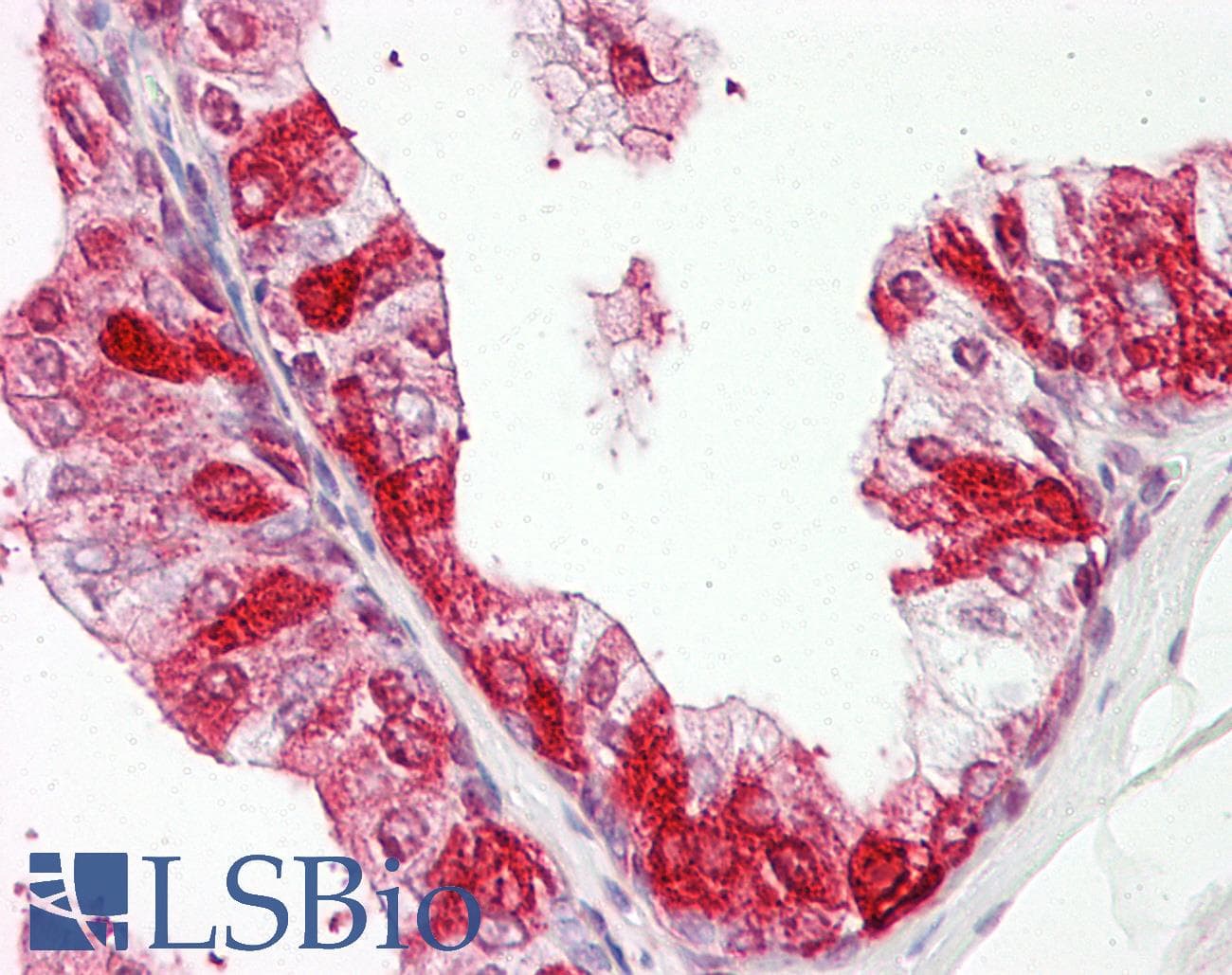 ZNF385A / ZNF385 Antibody (N-Terminus)