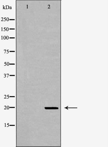 Polyclonal Rabbit anti-Human IL1RN Antibody (IHC, WB)