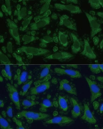 ENO1 / Alpha Enolase Antibody