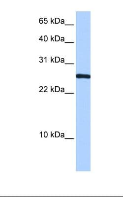 CIRP / CIRBP Antibody (N-Terminus)