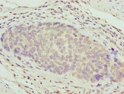 Polyclonal Rabbit anti-Human ZNF177 / PIGX Antibody (IHC)