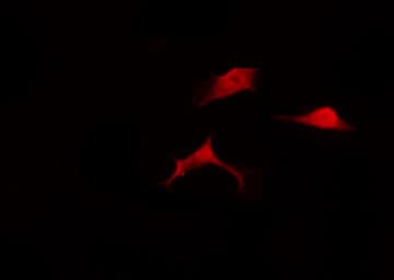 ACKR2 / CCR10 / D6 Antibody