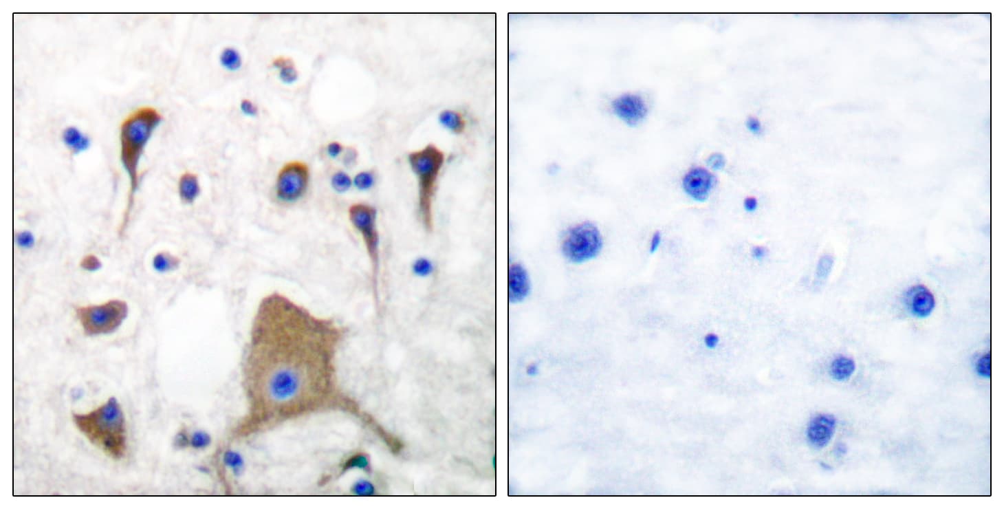 GRIK1 / GLUR5 Antibody (aa10-59)