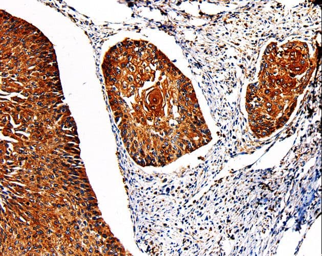 Polyclonal Rabbit anti-Human PKM / Pyruvate Kinase, Muscle Antibody (IHC, WB)