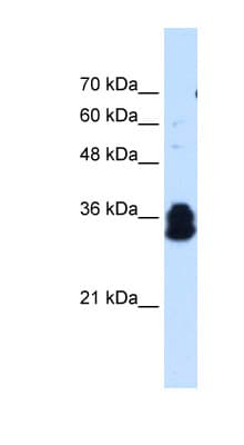 Polyclonal Rabbit anti-Human FAM134B Antibody (aa160-209, IHC, WB)