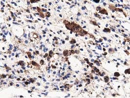 MICAL1 / MICAL Antibody (clone OTI4B1, Carrier-free)