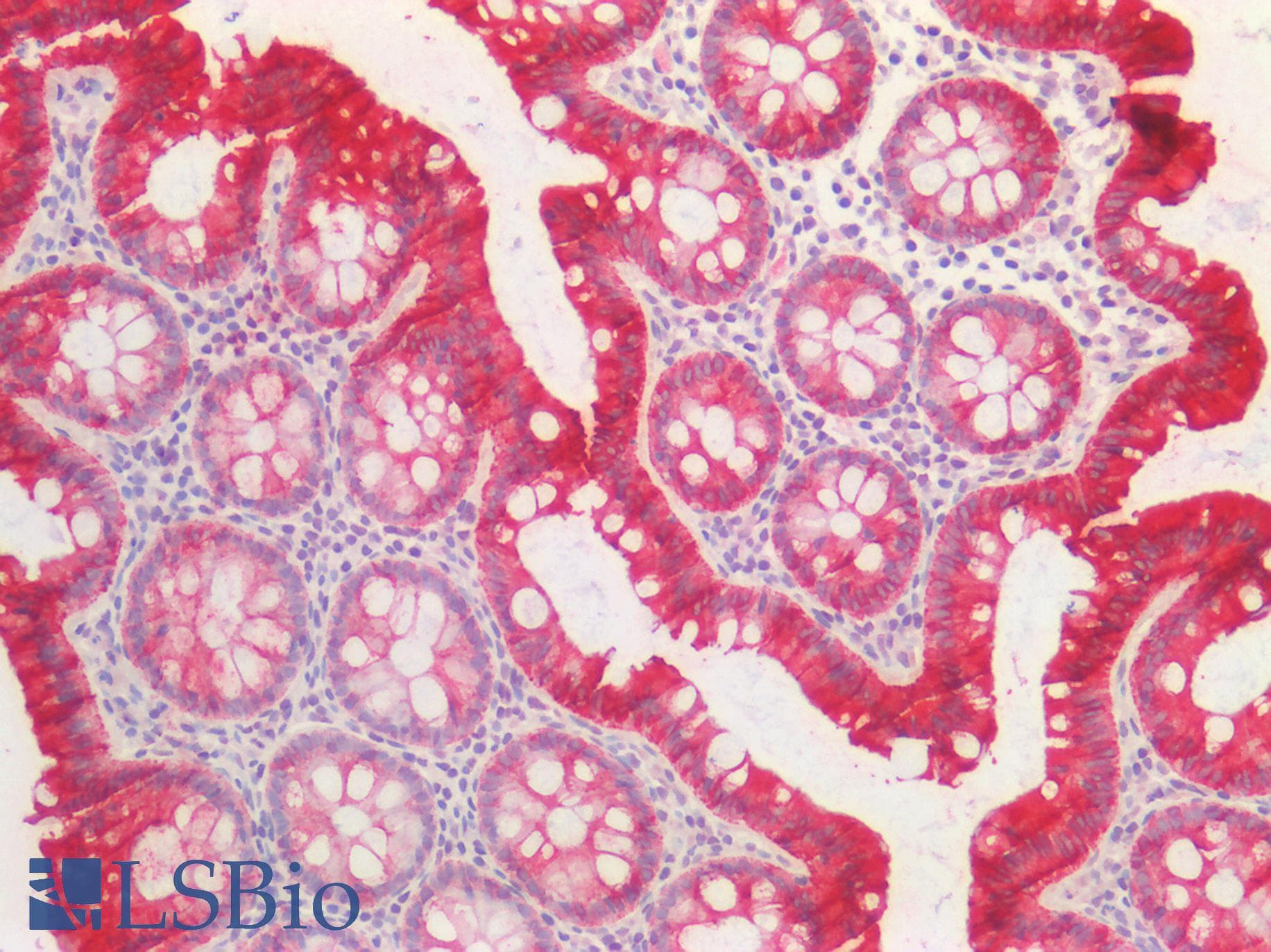 PathPlus™ KRT20 / CK20 / Cytokeratin 20 Antibody (aa48-60)