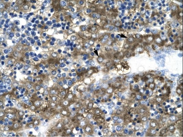 Polyclonal Rabbit anti-Human GATA2 Antibody (aa58-107, IHC, WB)