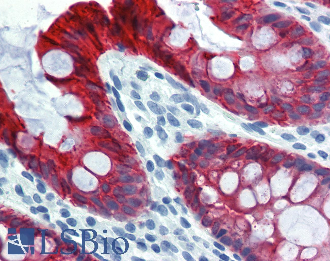 PathPlus™ KRT18 / CK18 / Cytokeratin 18 Antibody (clone DA-7)