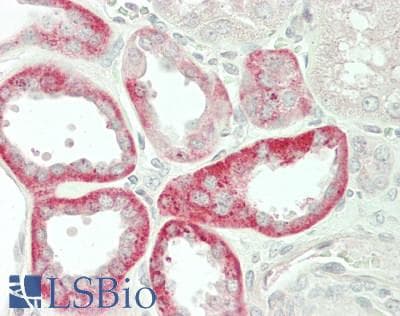 IHC-plus™ STC1 / Stanniocalcin Antibody