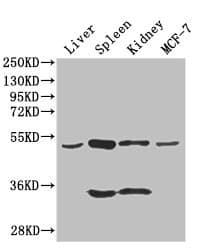 Corneodesmosin / CDSN Antibody