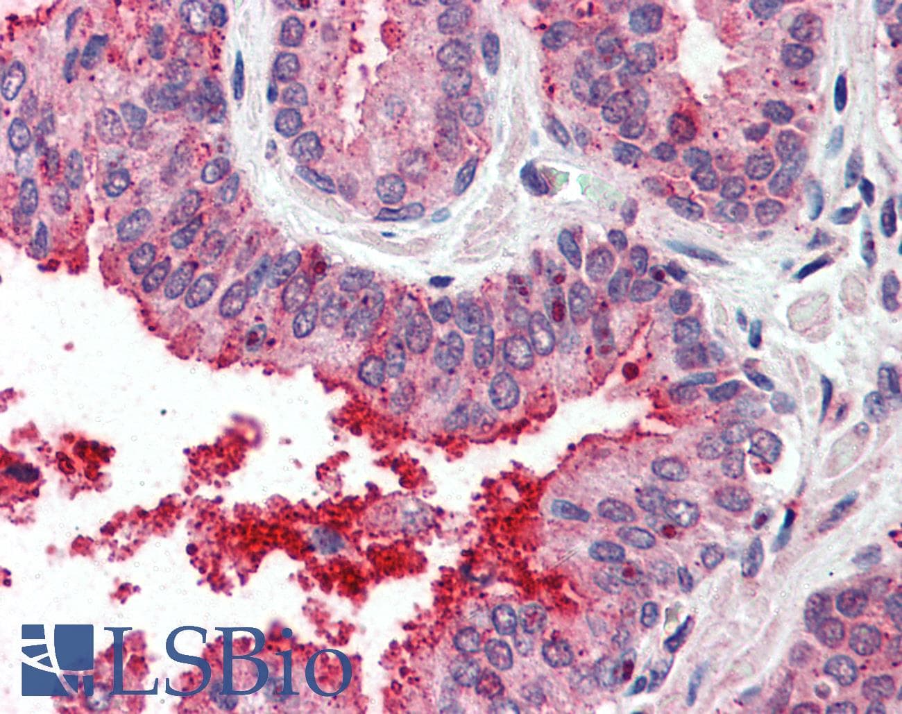 IHC-plus™ TM4SF6 / TSPAN6 Antibody (Internal)