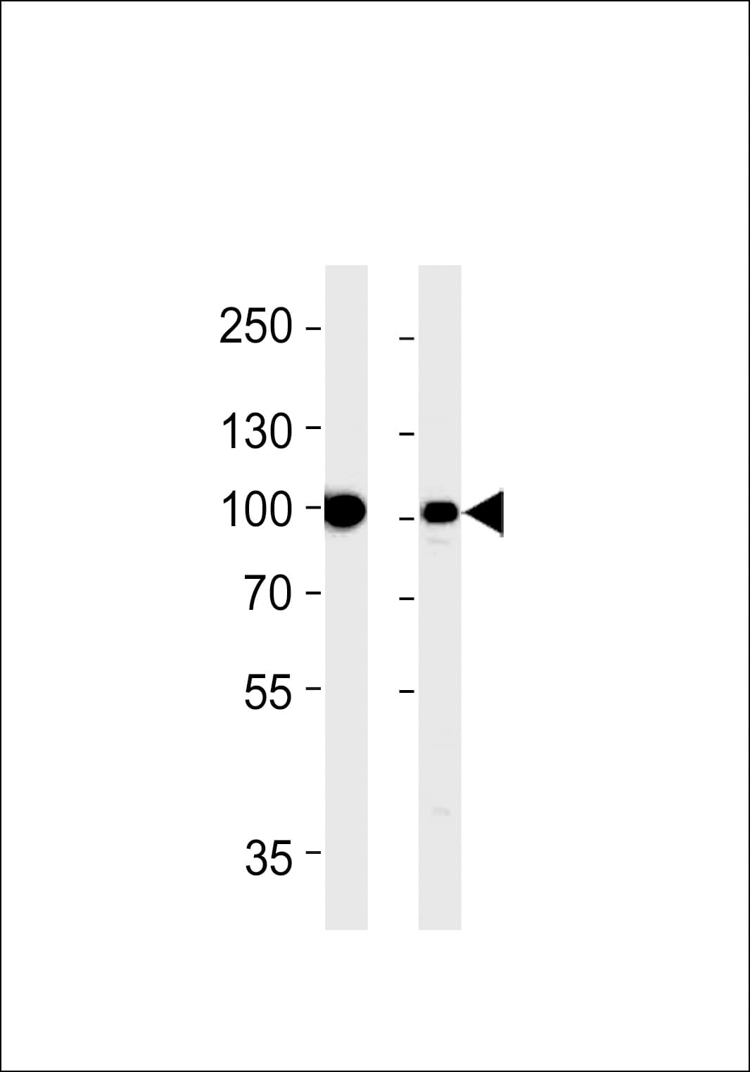 Polyclonal Rabbit anti-Human VIL1 / Villin Antibody (aa180-207, IHC, WB)