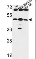 B3GNT5 Antibody (aa118-145)
