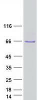 Human UBXD7 Protein (Recombinant Myc-DDK (Flag))