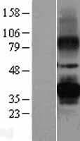 PRPH2 Protein (Over-Expression Lysate Myc-DDK (Flag))