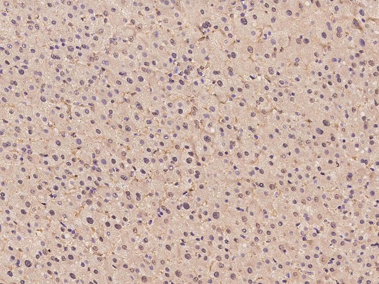 HPD Antibody