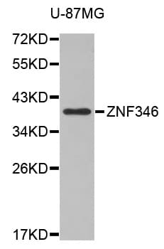 Polyclonal Rabbit anti-Human ZNF346 Antibody (WB)