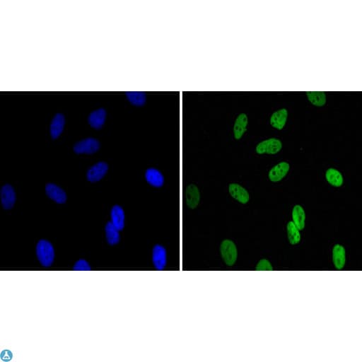 CBX1 / HP1 Beta Antibody
