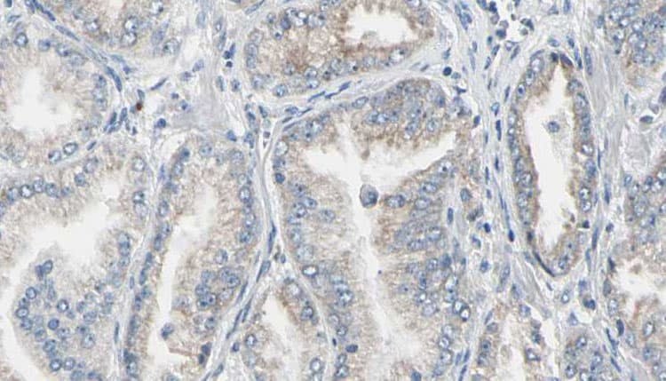 FKBP1A / FKBP12 Antibody