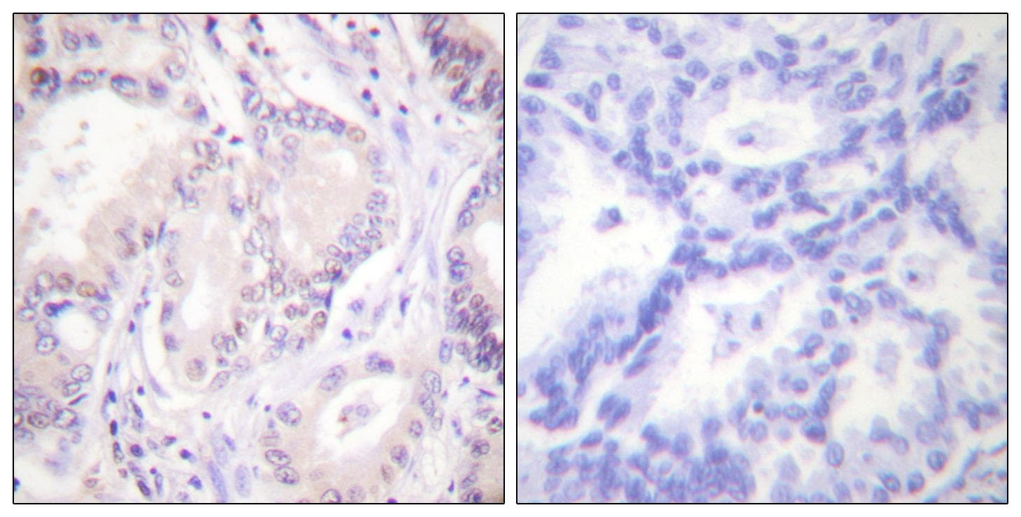 CDC6 Antibody (phospho-Ser54)