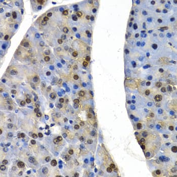 Cullin 4B / CUL4B Antibody