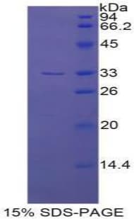 Human ECE-1 Protein (Recombinant His-T7)