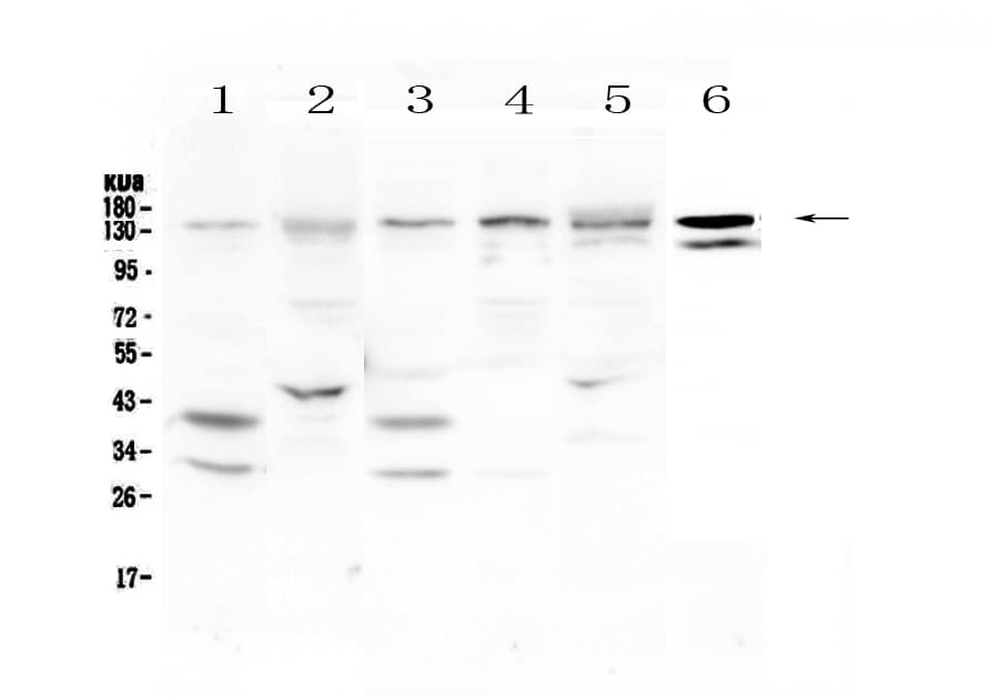 Polyclonal Rabbit anti-Human EPS15 Antibody (WB)