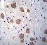 Polyclonal Rabbit anti-Human RGS7 Antibody (aa440-469, IHC, WB)