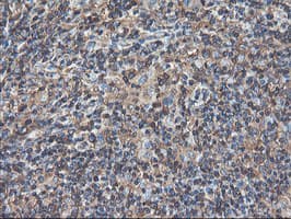 TUBAL3 Antibody (clone OTI4C5)