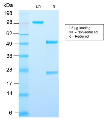 PathPlus™ AMACR / P504S Antibody (aa 297-394, clone AMACR/2748R)