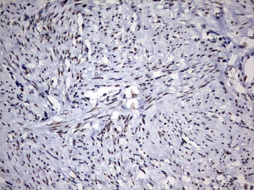 DDX56 Antibody (aa323-547, clone OTI5C1)