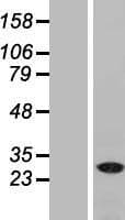 NAA40 Protein (Over-Expression Lysate Myc-DDK (Flag))