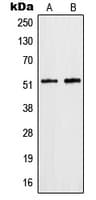 Polyclonal Rabbit anti-Human HNRNPF / hnRNP F Antibody (N-Terminus, IF, WB)