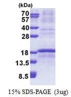 Human RPL34 / Ribosomal Protein L34 (Recombinant His)