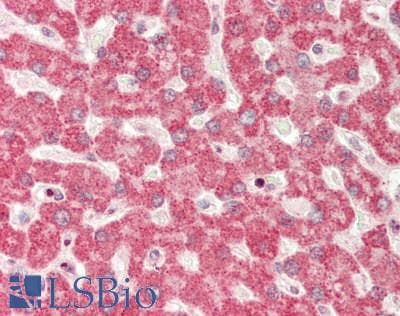 Polyclonal Rabbit anti-Human RPN1 / Ribophorin I Antibody (aa468-517, IHC, WB)