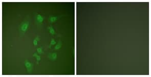 IHC-plus™ Polyclonal Rabbit anti-Human SMAD2 Antibody (aa418-467, IHC, IF, WB)